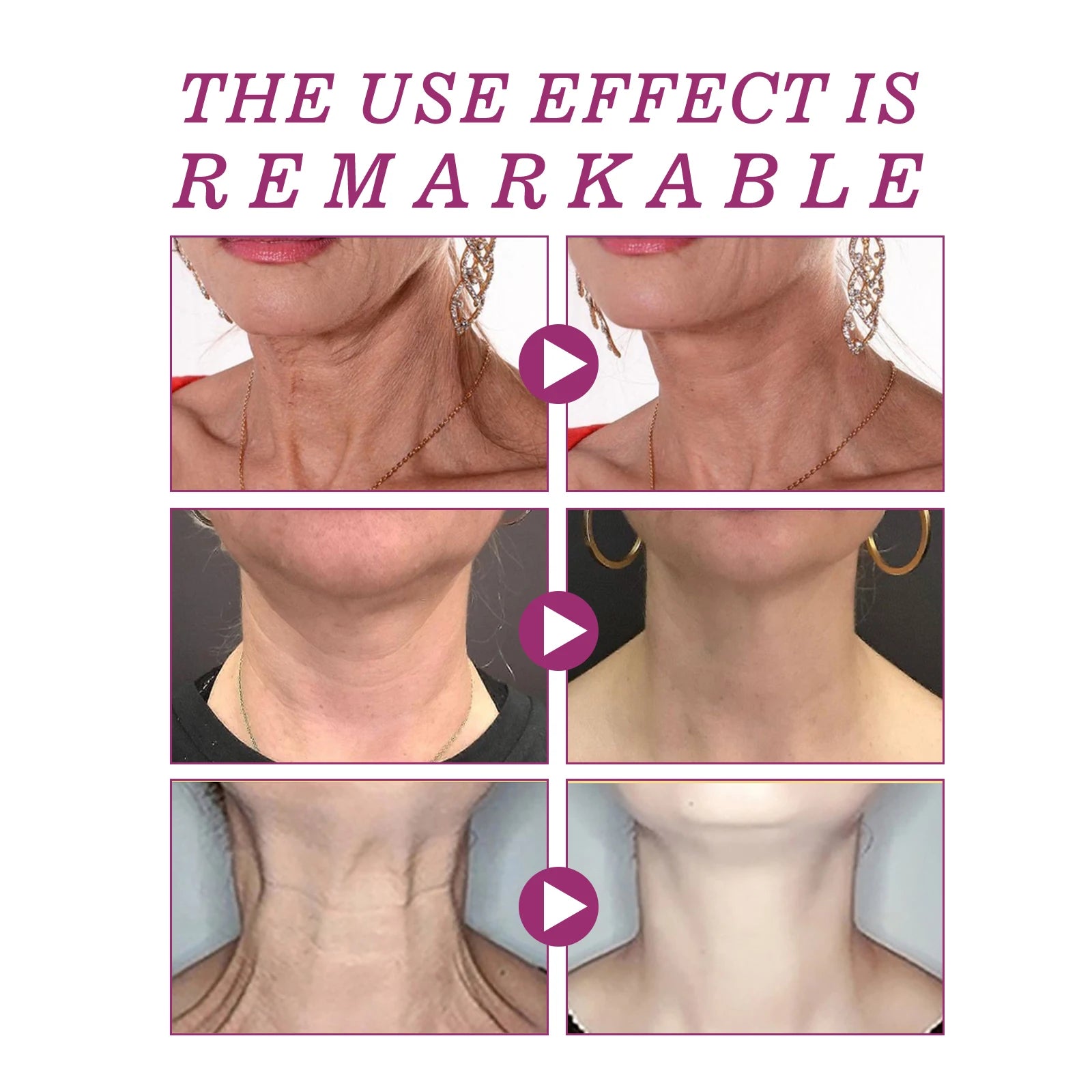 Hydrolyzed Collagen Neck Cream Anti Aging Lifting Firming Lightening Lines Nourish Eliminate Double Chin Face Skin Car