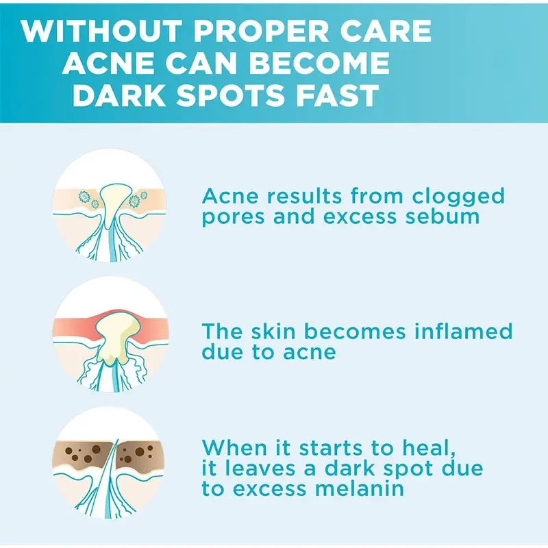 30ml Garnier Whitening Essence Removes Acne Marks Facial Repair Serum Shrinks Pores Moisturizes Essence