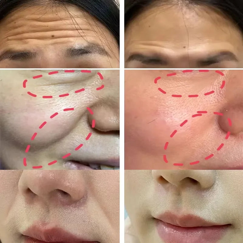 Collagen Wrinkle Removal  Anti-Aging Firming Lift Brighten Facial Dull Skin Moisturizer Cosmetics