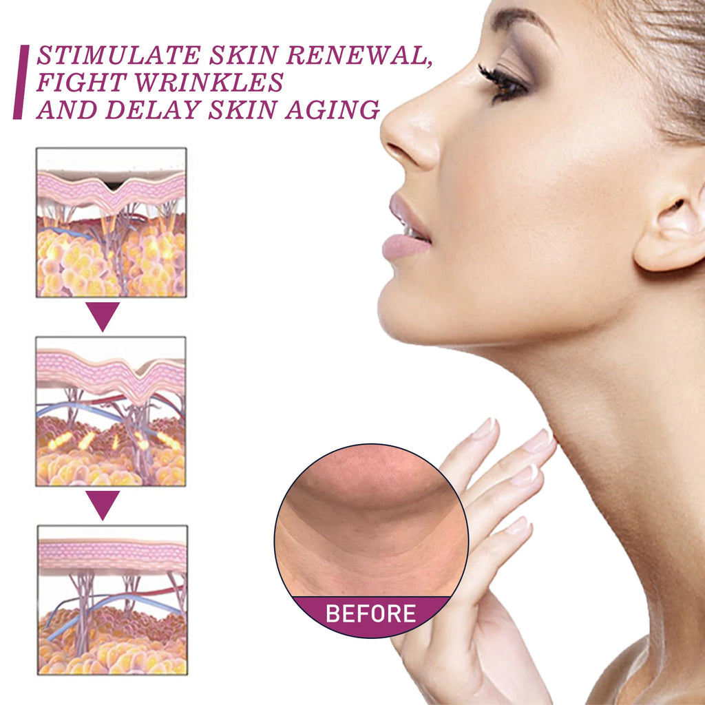 Hydrolyzed Collagen Neck Cream Anti Aging Lifting Firming Lightening Lines Nourish Eliminate Double Chin Face Skin Car