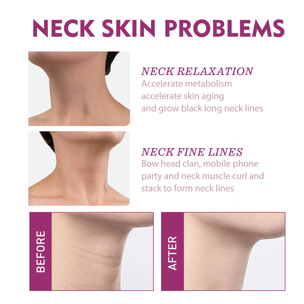 Hydrolyzed Collagen Neck Cream Anti Aging Lifting Firming Lightening Lines Nourish Eliminate Double Chin Face Skin Car