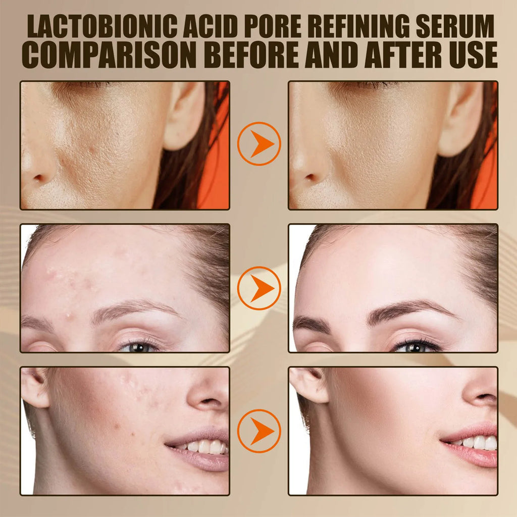 Serums Facial Lactobionic Acid Skin Care Face Serums Reduce Wrinkles Fine Eye Essence Firming Lifting
