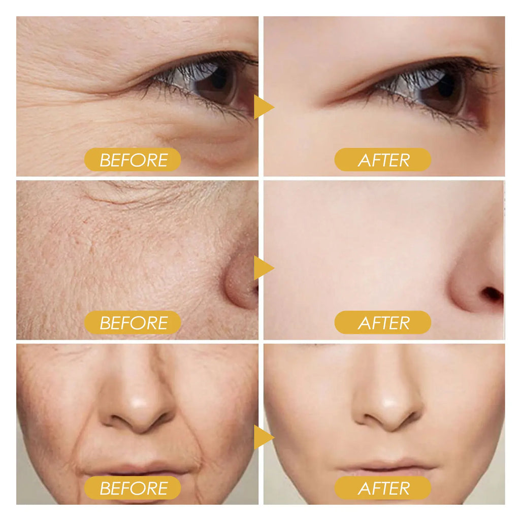 Anti Wrinkle Instant Remover Anti-wrinkle Serum Face Neck Forehead Wrinkles Removal Anti-aging Skin Firming